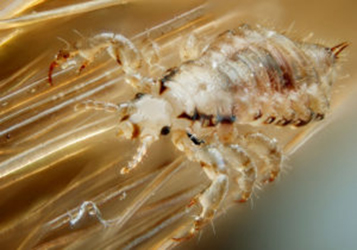 head lice